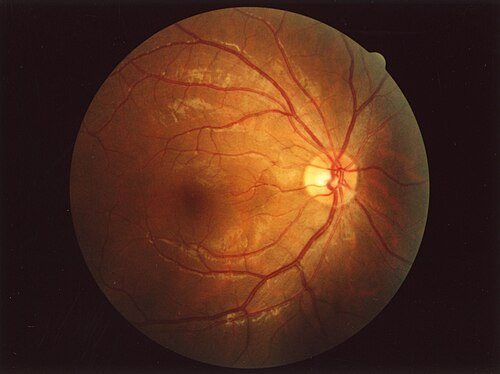 Retina Scan